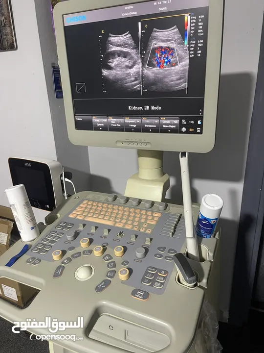 شايسون التراساوند Ultrasound نسائية