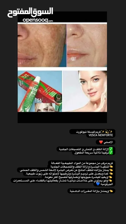 كريم فيسكا نيوفورت