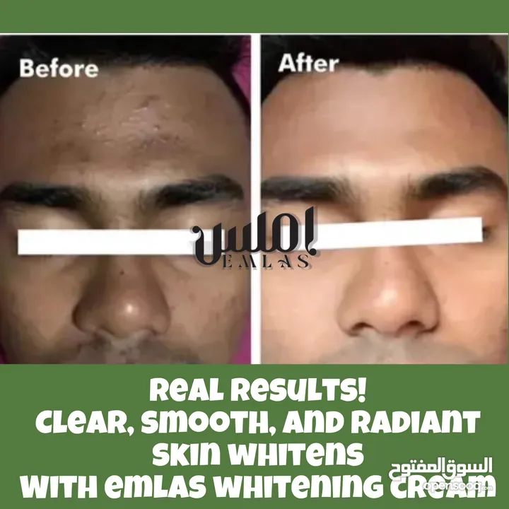 كريم تبييض الوجه في غضون 8 أيام. Face whitening cream