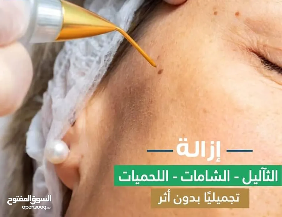 جهاز ازالة الثواليل و الوشم الزوائد الجلديه التصبغات جهاز بلازما المحمول بلازماج