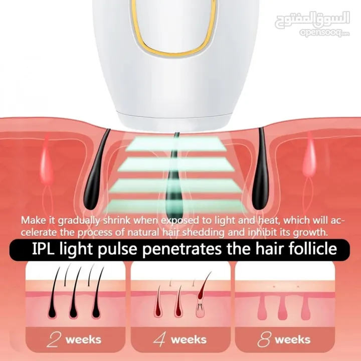 ليزر إزالة الشعر بتقنية IPL لكامل الجسم