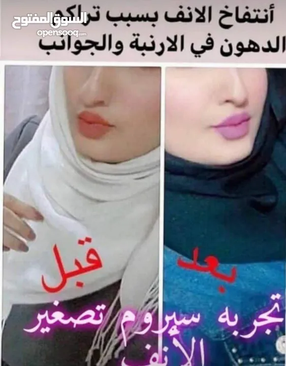 لوگر سيروم+تقويم أنف