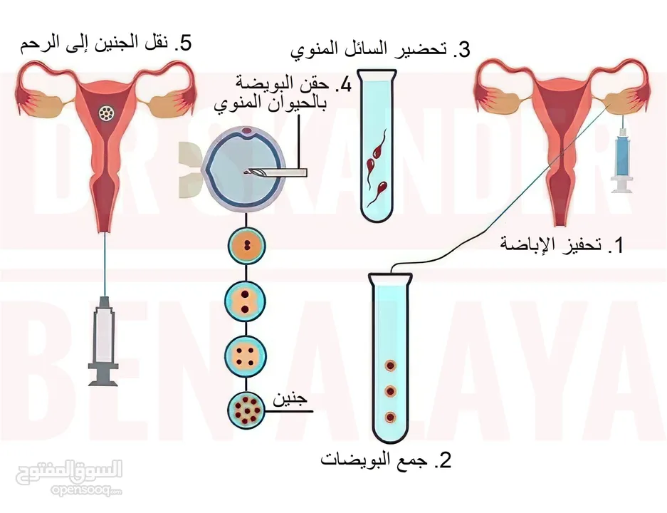 دكتورة استشارية حقن مجهرى اوطفال انابيب