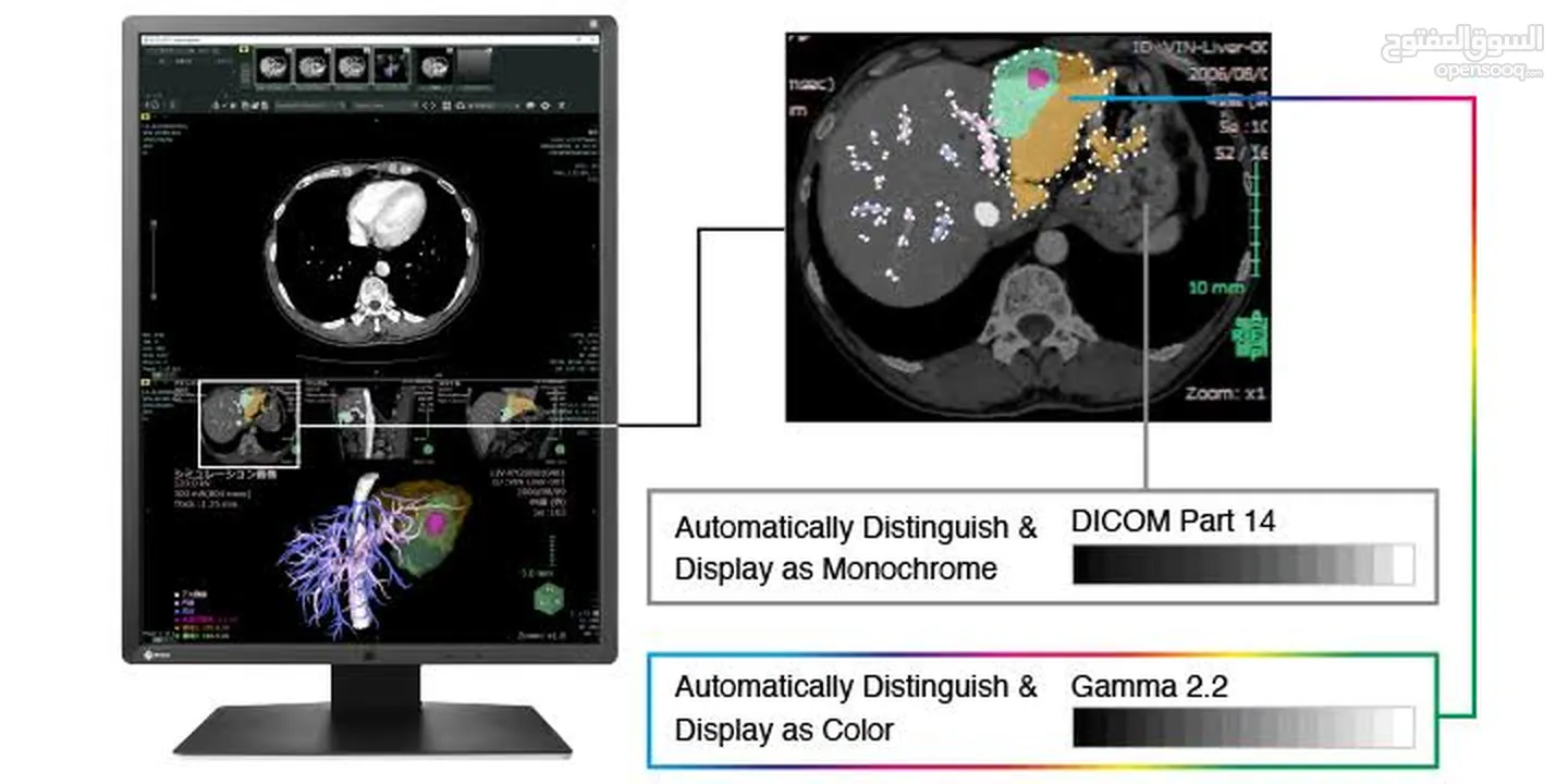 RX250 2MP 21.3" LCD Medical Display - RadiForce  EIZO‏