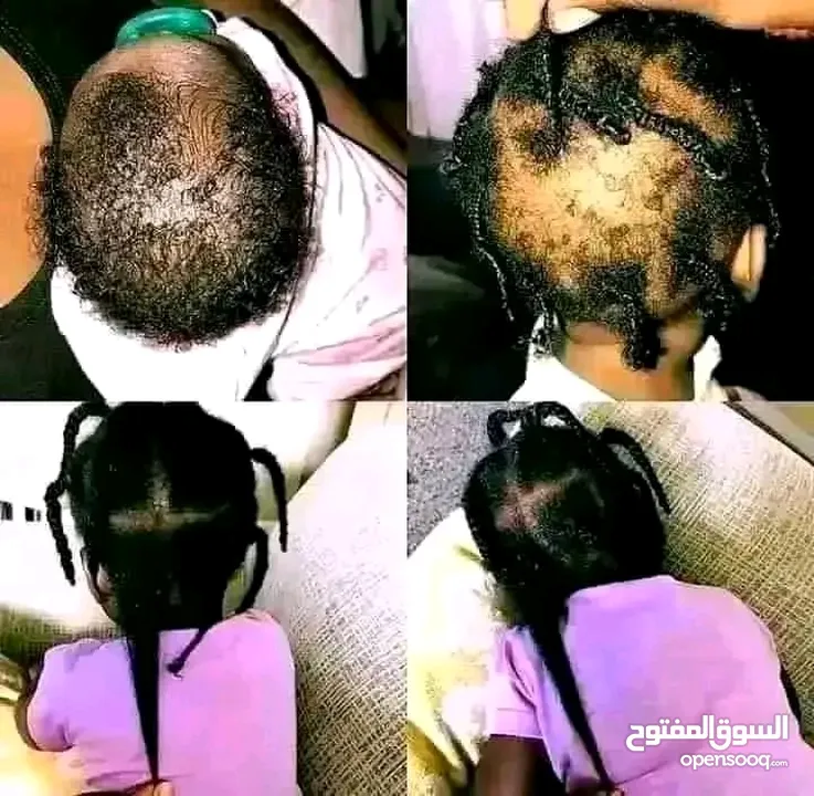 *زيت جيكا  الاردني الاصلي* من فوائد الزيت الشهير و المعالج الاول للشعر ناسب 95٪من الحالات  1ـ ت