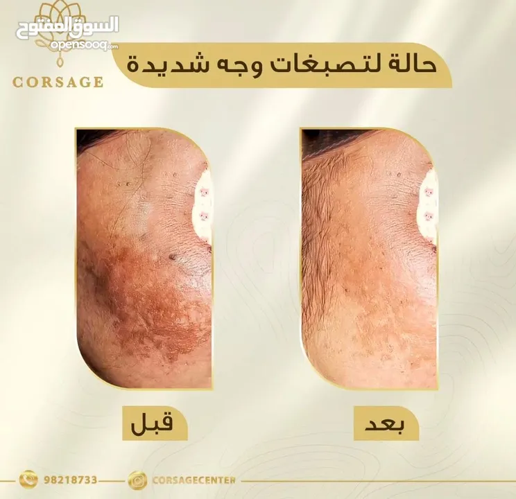 خدمات مركز تجميل