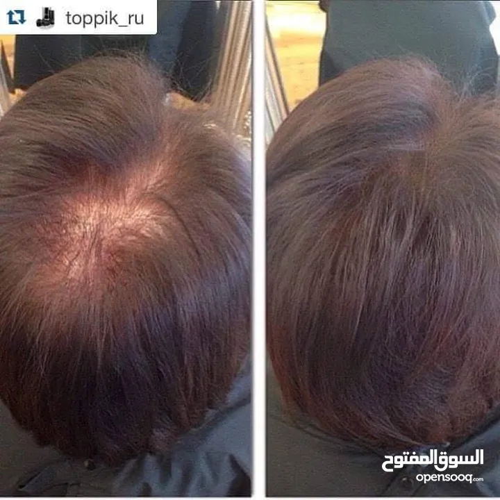 توبيك #Toppik ، الحل الفوري للشعر الخفيف والصلع تألق بشعر يبدو أكثر كثافة يعوض الشعر المفقود بزيادة
