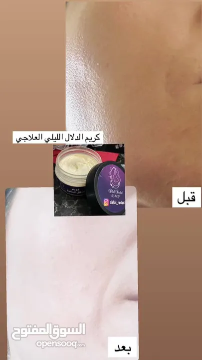 كريم الدلال الليلي العلاجي