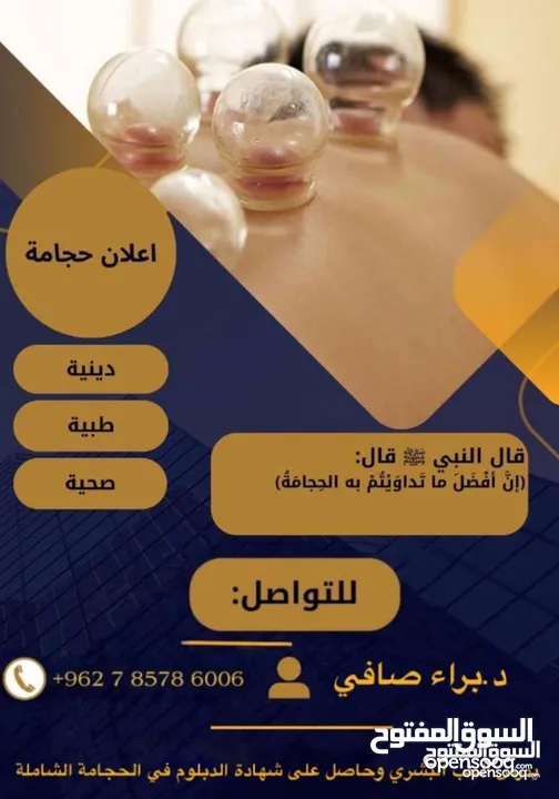 حجامة نبوية على يد طبيب
