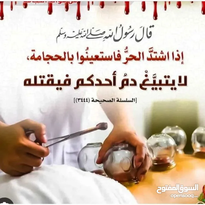 العلاج بالحجامة تقويم الفقرات الكيروبراكتك الابر الصينيه الفوطه الناريه والطب البديل