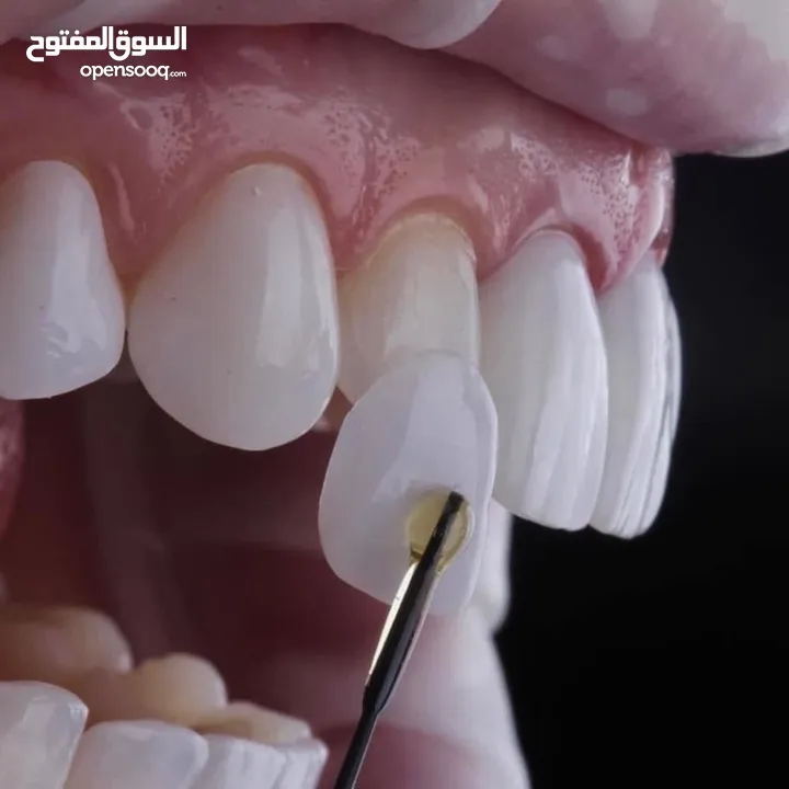مختبرات لين للاسنان لصناعة كافة أنواع التركيبات الثابتة والمتحركة والتركيبات التقويمية وزراعة لاسنان