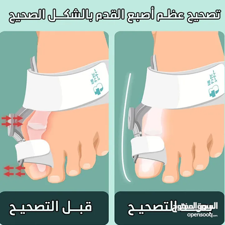 مشد اداه تصحيح وضعية اصبع القدم مشدات  اصابع القدم مشد طبي