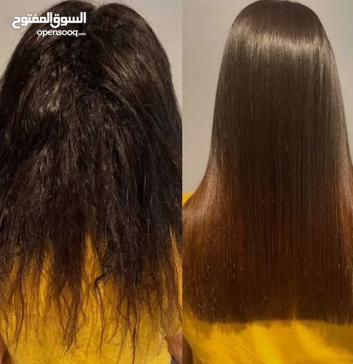 اخصائية بروتين