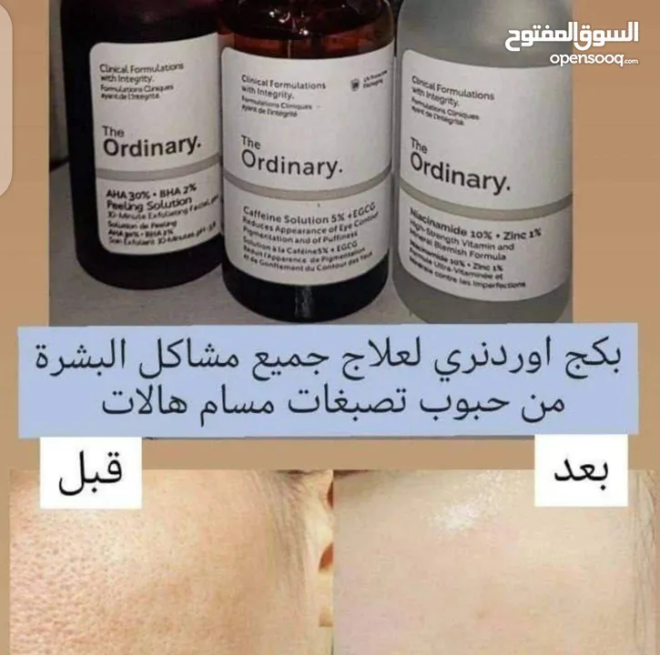 بعض منتجات شركتنا ( مسمن و منحف و مبيض و معالج للتجاعيد للبشرة  و وكريم و اكسسوارات و سيروم )