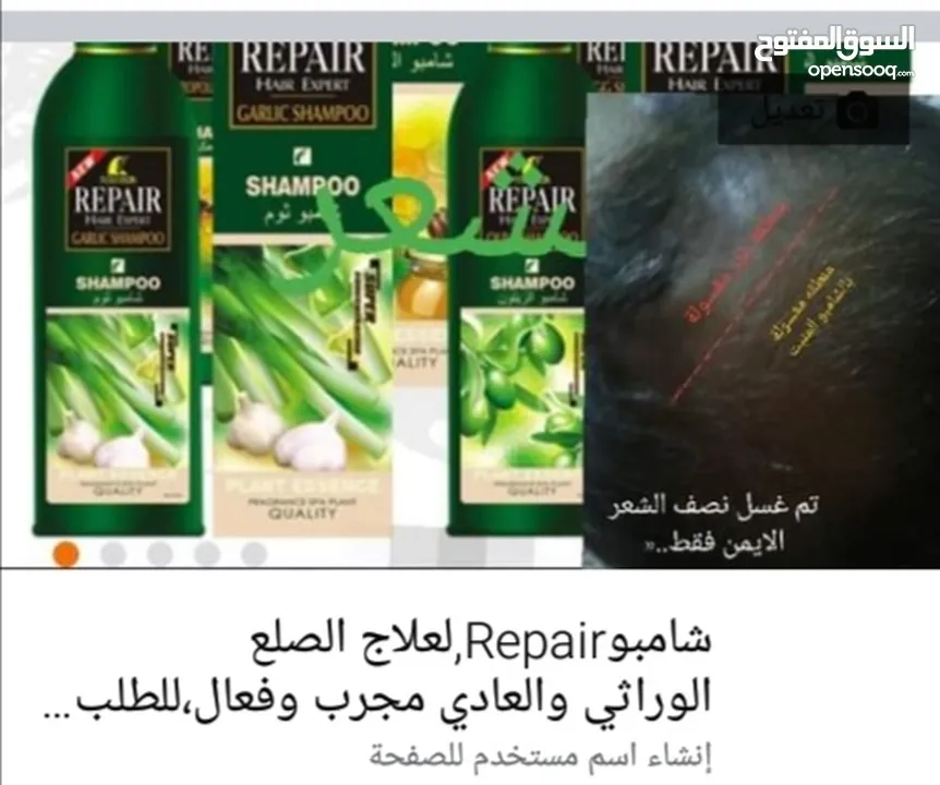 شامبو معالج للصلع منبت لايصدق"Repairعبوتين)(2)