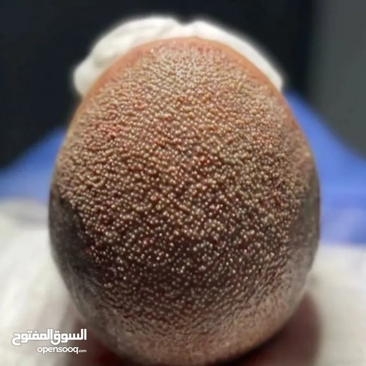 مرکز زراعة الشعر و زراعة احواجب