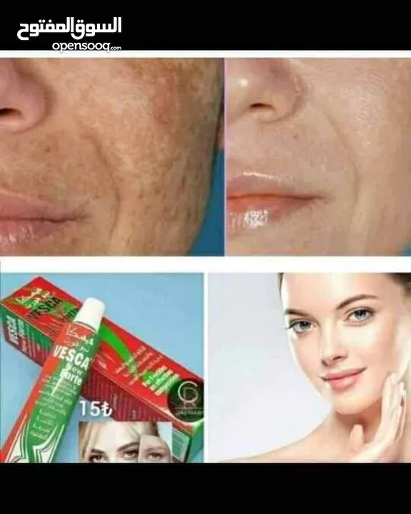 كريم فيسكا نيوفورت Vesca newForte لازالة الكلف و النمش و التصبغات الجلدية تركيبة ثلاثية سريعة