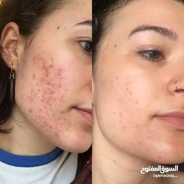 مشروب Indigo طبيعي غني بالمكونات النباتية  Indigo مشروب نباتي لتعزيز النشاط  مشروب صحي بنكهة طبيعية