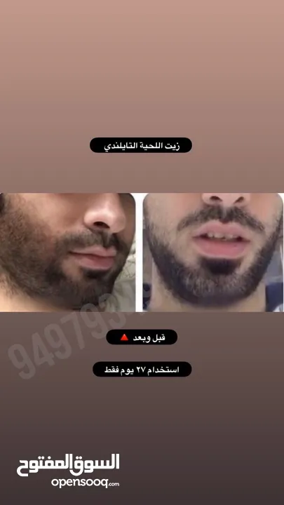 إنبات وتكثيف اللحية 'مجرب ومضمووووون