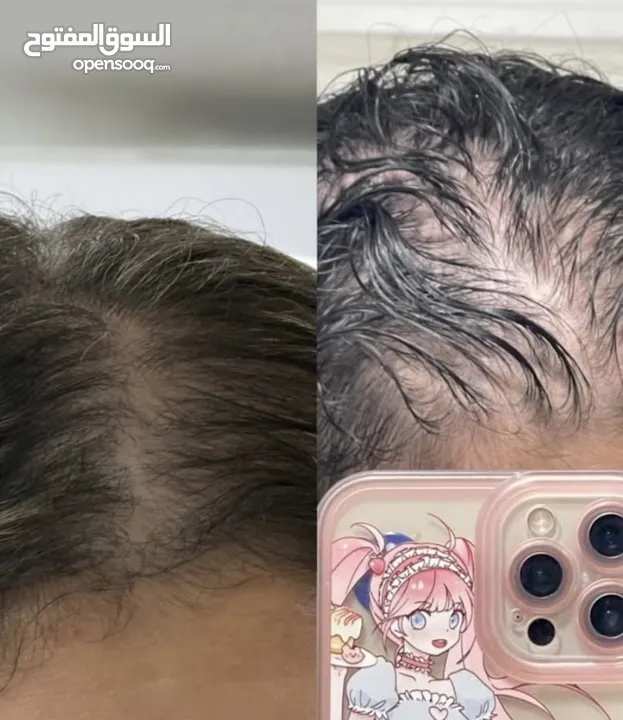 زيت رابونزل لتكثيف الشعر وإطالته