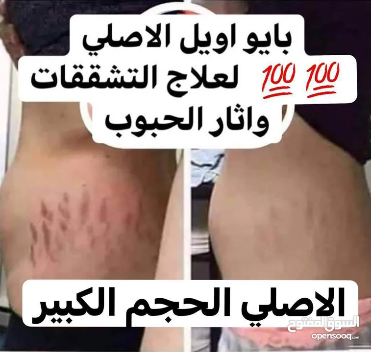 بايو اويل Bio oil