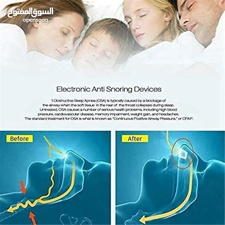 جهاز مضاد للشخير بحجم صغير وقابل للشحن Anti Snoring Device, Electric Variable Snore Solution