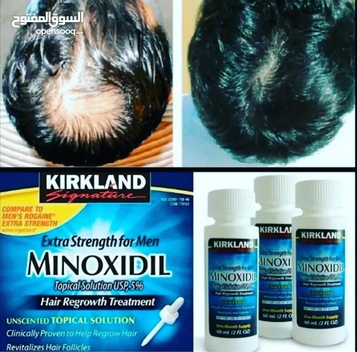 minoxidil منتج منع الصلع ونمو الشعر واللحيه