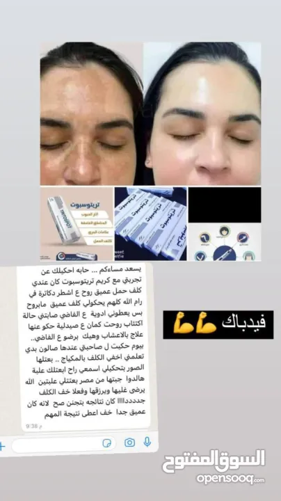 كريم #تريتوسبوت الأصلي آمن على البشرة  نكفل لكم النتائج  يستخدم مرهم تريتوسبوت لعلاج الحالات