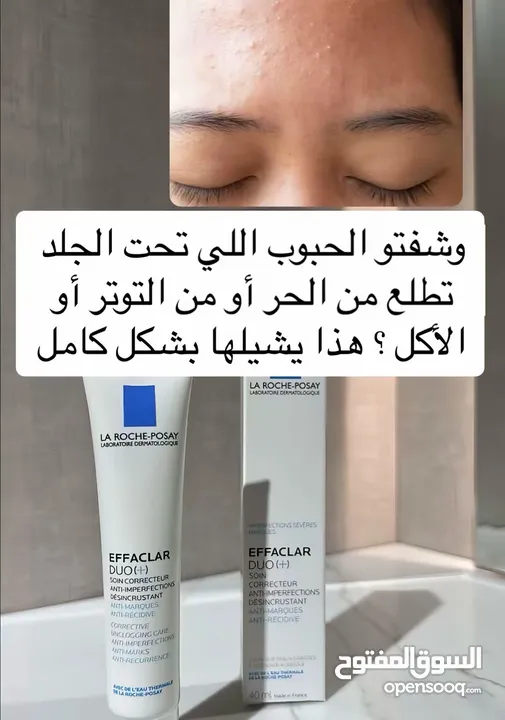كريم لازاله الحبوب طبي