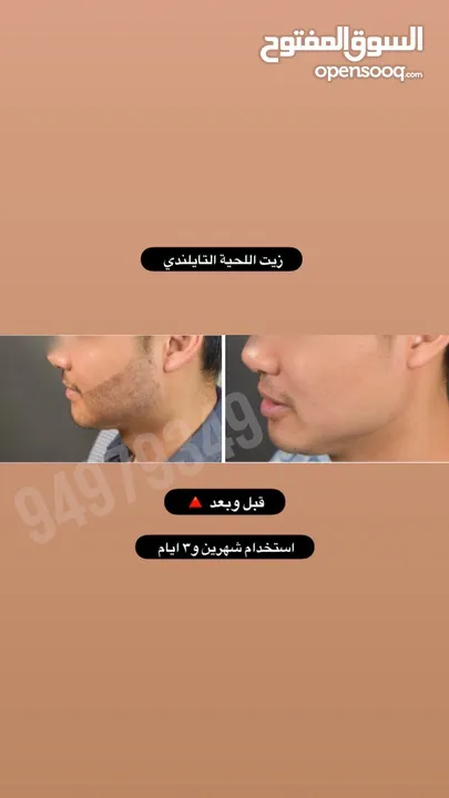 ينبت ويكثف اللحية والشنب/ مجرب ومضمون