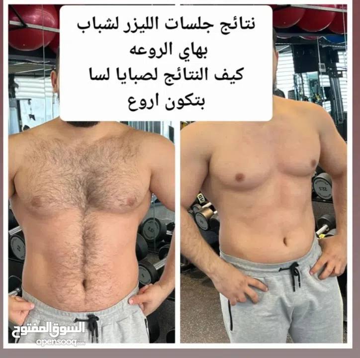 جهاز الليزر active sprite الاحدث جهاز ازاله الشعر بالليزر