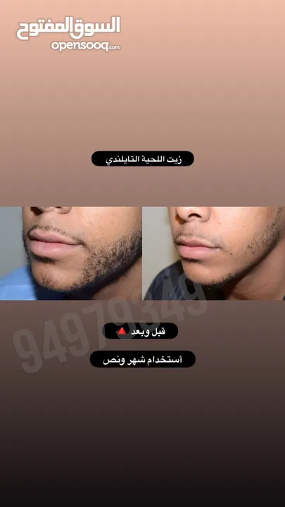 ينبت ويكثف اللحية والشنب/ مجرب ومضمون