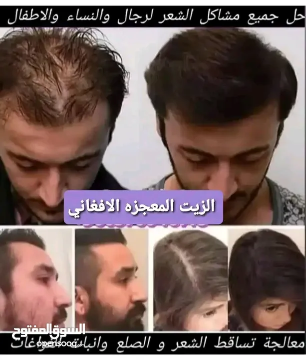 قطر الزيت الافغاني الاصلي الامثل لعلاج جميع مشاكل الشعر