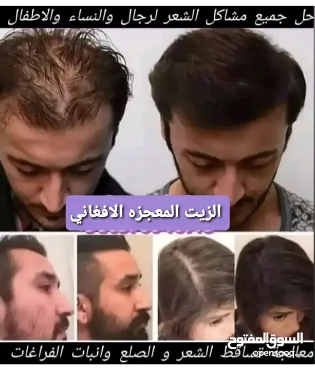 قطر الزيت الافغاني الامثل لعلاج مشاكل الشعر