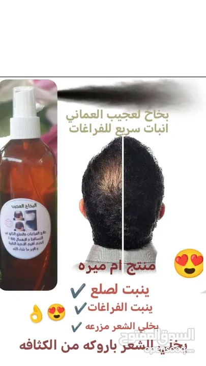 البخاخ العجيب للصلع