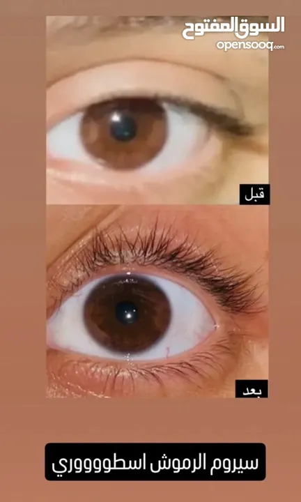 زيت رابونزل لتكثيف الشعر وإطالته