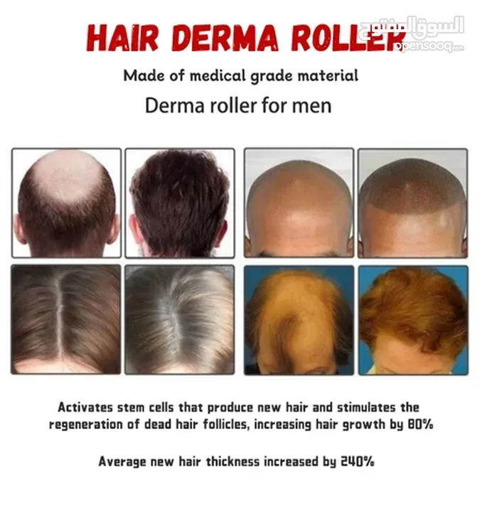 ديرما رولر - Derma roller