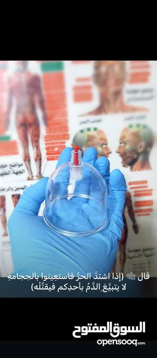 الحجامة للنساء..شفاء الحجامة ليس بكثرة الدم و إنما بالتشريط السليم والطريقة المثلى.. الحجامة وصية ..