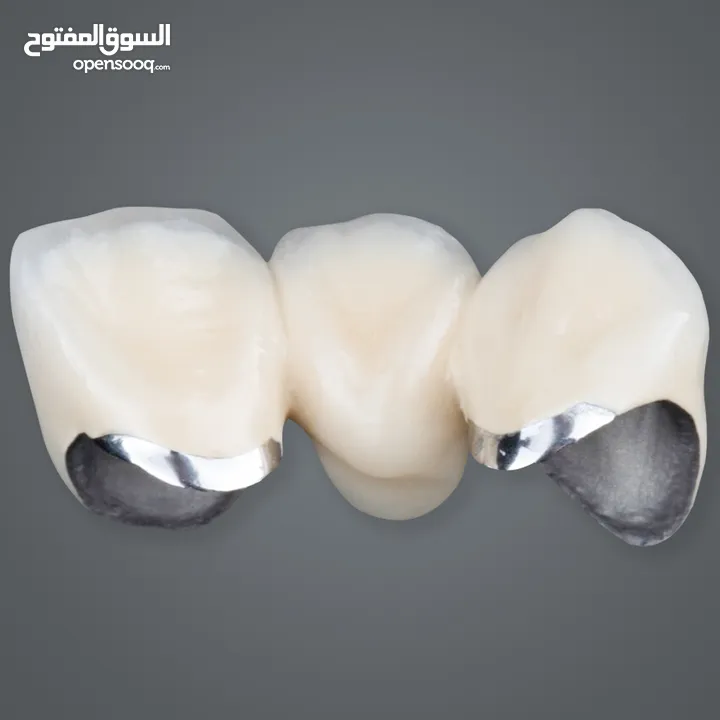 مختبرات لين للاسنان لصناعة كافة أنواع التركيبات الثابتة والمتحركة والتركيبات التقويمية وزراعة لاسنان