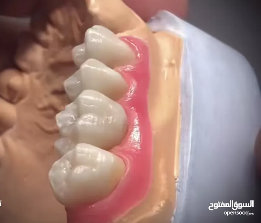 مختبرات لين للاسنان لصناعة كافة أنواع التركيبات الثابتة والمتحركة والتركيبات التقويمية وزراعة لاسنان