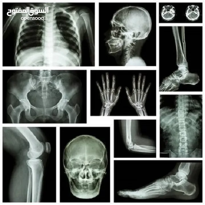 مركز اشعه ذات سمعه مرموقه وحركة ممتازه للبيع