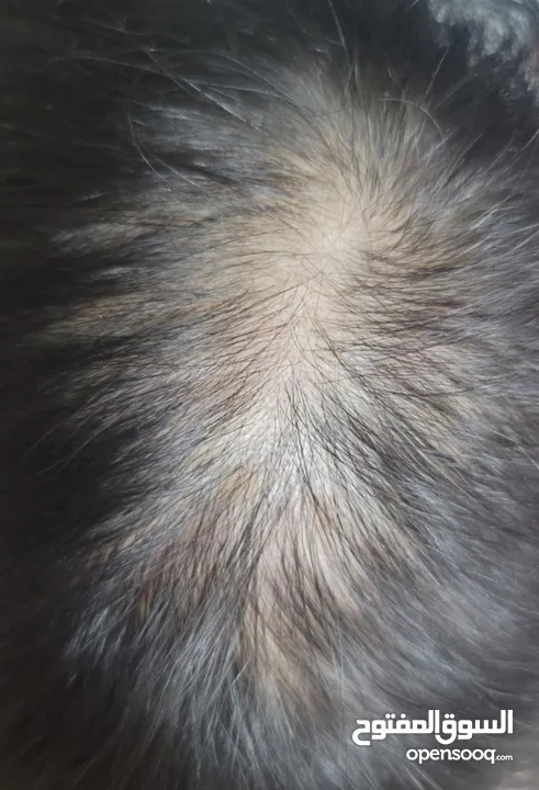 سيروم لعلاج تساقط الشعر ممتاز والنتائج خلال 4 اسابيع فقط