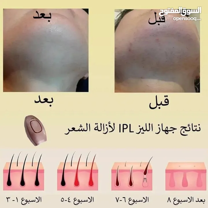 جهاز الليزر المنزلي ماركة ipl