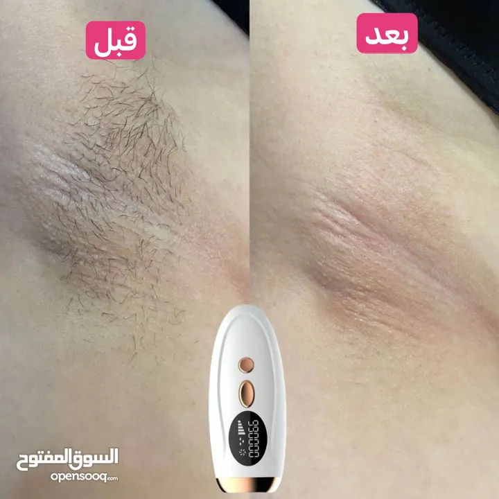 IPL HAIR REMOVAL DEVICE  الليزر الرهيب