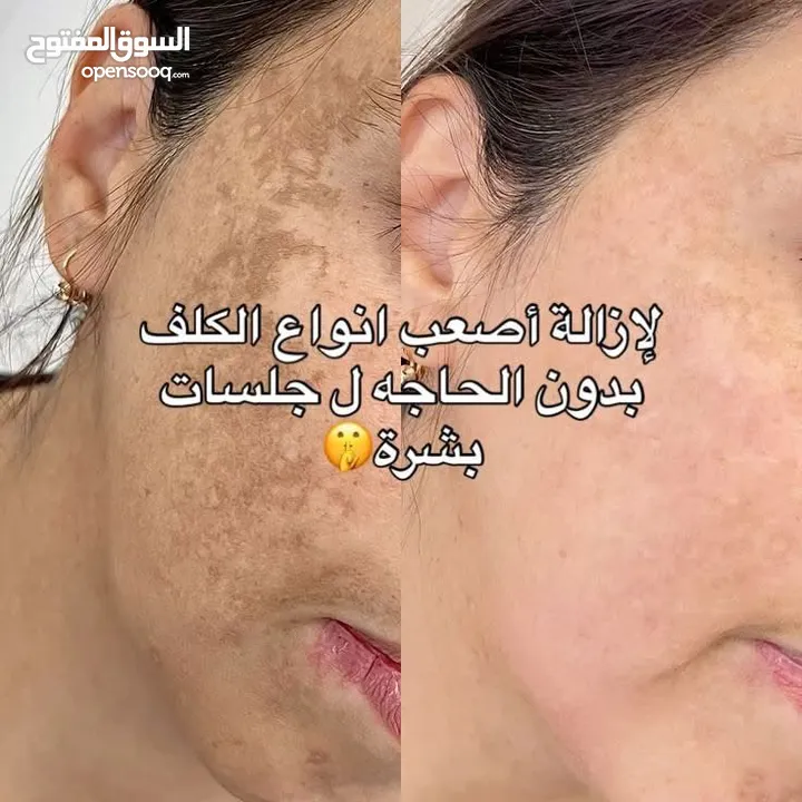 كريم هاي كوين