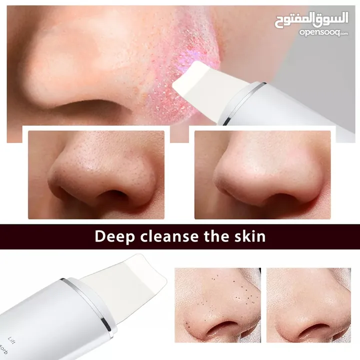 جهاز تنظيف البشرة بعمق بالموجات التراسونيك تنظيف الزيوان و الجلد سكن سكرابر Ultrasonic Skin Scrubber