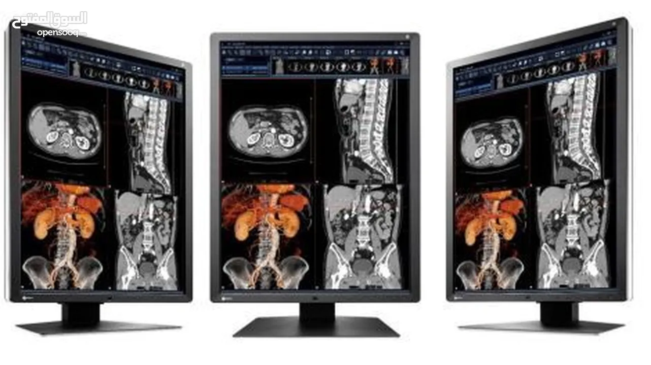 RX250 2MP 21.3" LCD Medical Display - RadiForce  EIZO‏