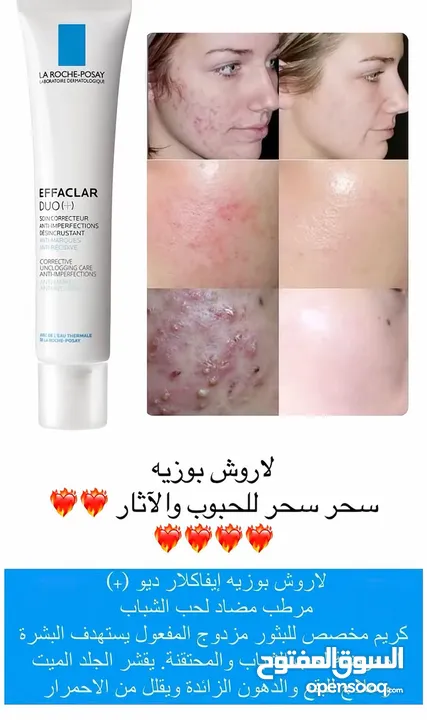 كريم لازاله الحبوب طبي