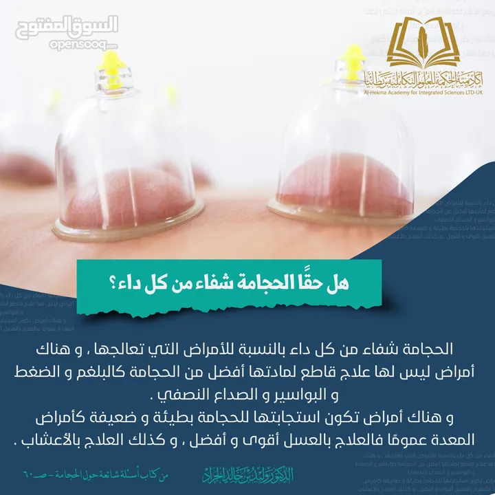 الحجامة للنساء..شفاء الحجامة ليس بكثرة الدم و إنما بالتشريط السليم والطريقة المثلى.. الحجامة وصية ..