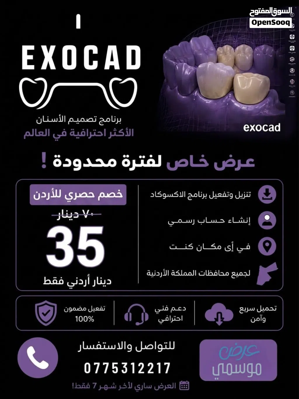 Exocad 3.2 for design